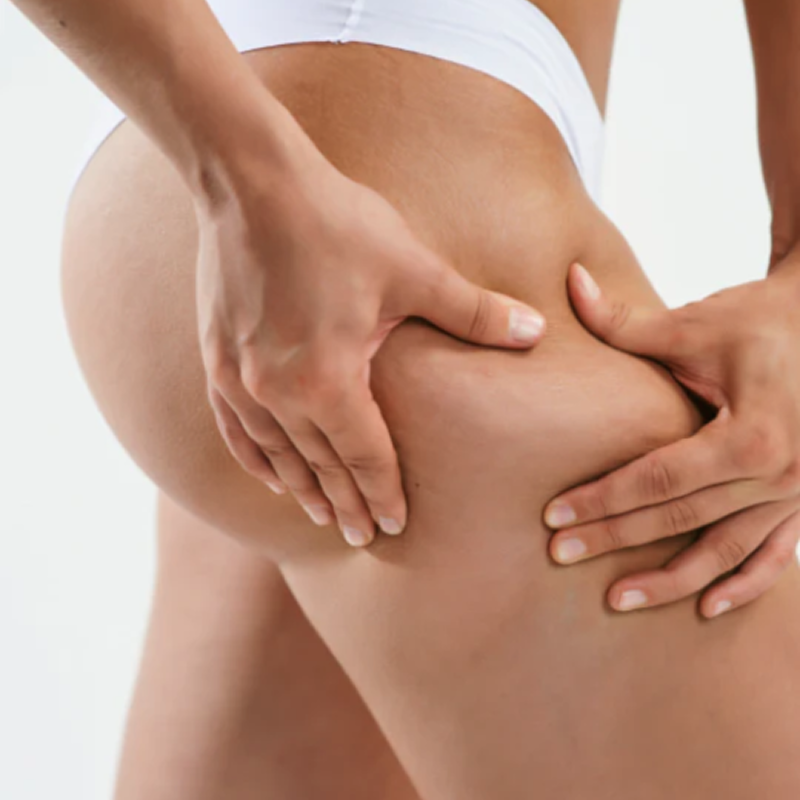MyBodyContour компоненти